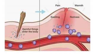 推剪刀头刮着痛怎么办 吞刀片怎么缓解疼痛